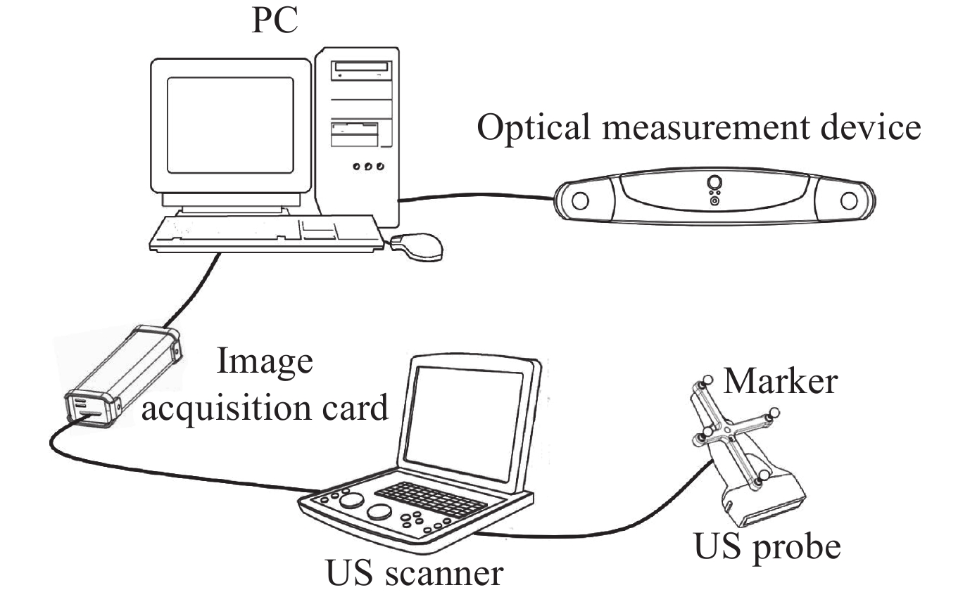 Real-Time 3D Ultrasound Imaging System Based On A Hybrid Reconstruction ...